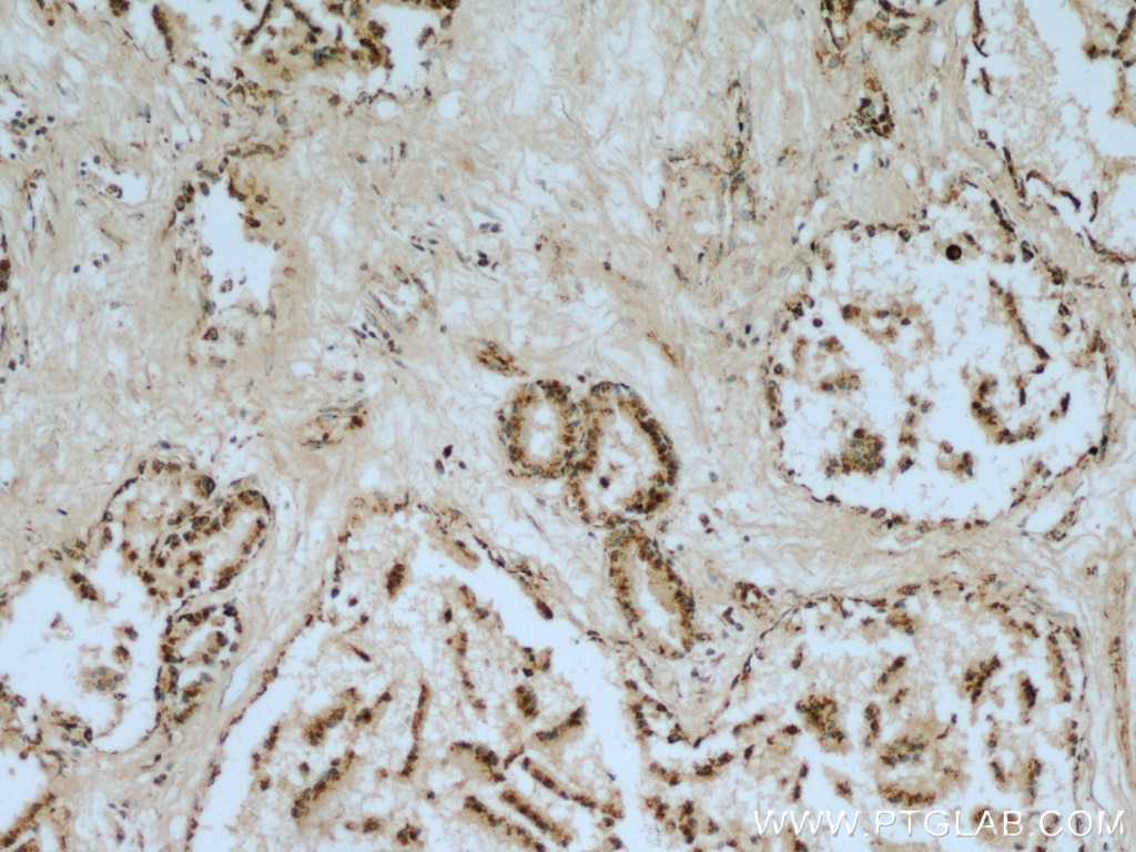 VDAC2 Antibody IHC human prostate tissue 11663-1-AP