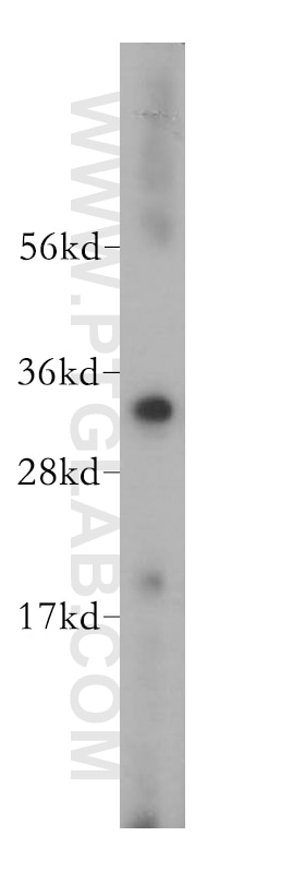 VDAC2 Antibody WB human heart tissue 11663-1-AP