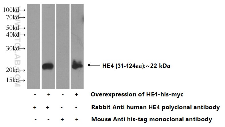 HE4 Antibody 14406-1-AP | Proteintech