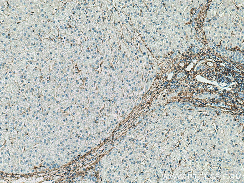 Alpha smooth muscle actin specific antibody (80008-1-PBS) | Proteintech