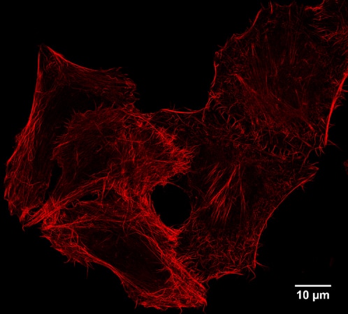 STED: IF of Spot-tagged Actin-Chromobody with Spot-Label Atto594 bivalent (1:1,000). Gated STED images were acquired with a Leica TCS SP8 STED 3X microscope with pulsed White Light Laser excitation at 590 nm and pulsed depletion with a 775 nm laser. Objective: 100x Oil STED White, NA: 1.4. Pixel size: 21 x 21 nm; z-Step size of z-Stacks: 0.16 μm. Images were deconvolved with Huygens Professional (SVI). STED images were recorded at the Core Facility Bioimaging at the Biomedical Center, LMU Munich.