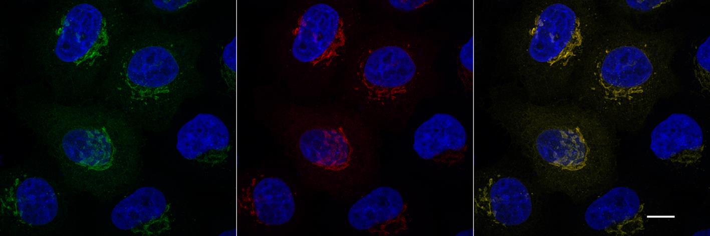 Confocal images of HeLa cells transiently transfected with MannosidaseII-GFP (green) and immunostained with GFP-Booster Alexa Fluor 568 (red). Nuclei were stained with DAPI (blue). Scale bar, 10 μm. Images were recorded at the Core Facility Bioimaging at the Biomedical Center, LMU Munich.