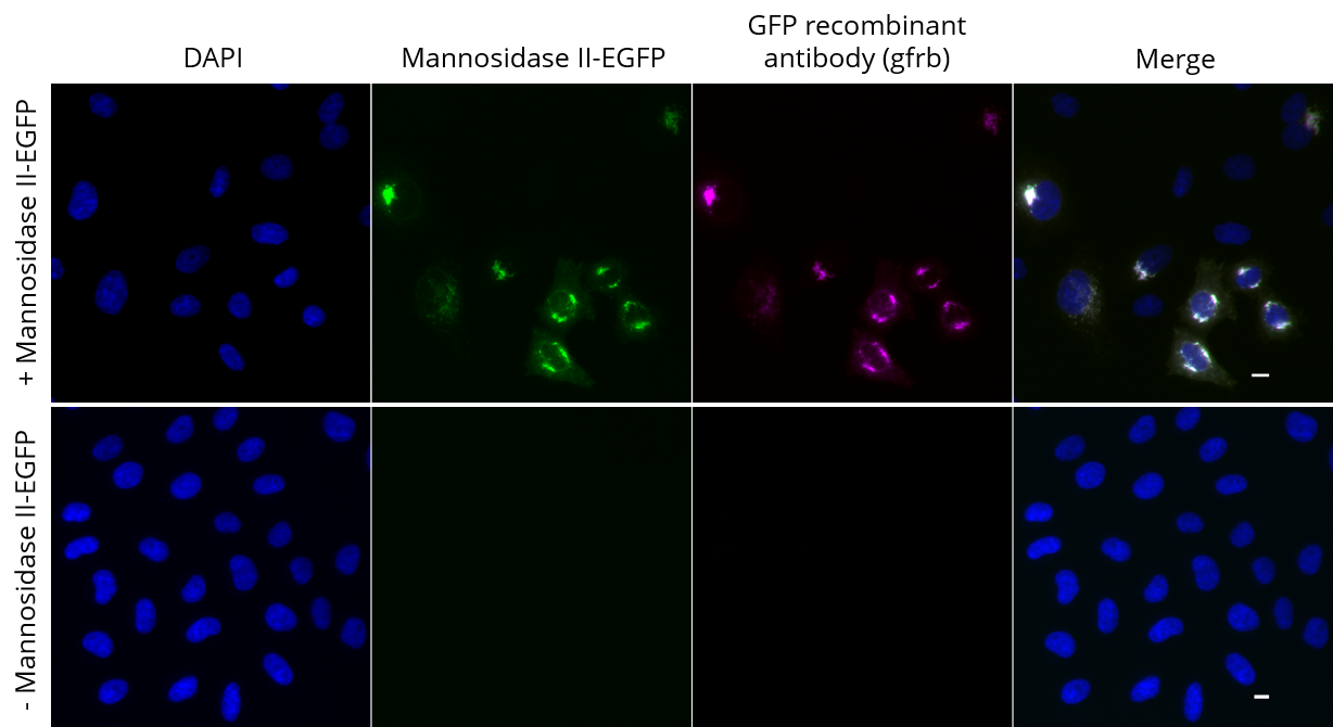 HeLa cells transiently expressing Mannosidase II-EGFP were immunostained with GFP recombinant antibody, VHH-rabbit IgG Fc fusion [CTK0201] (gfrb-20, 1:1,000) and Nano-Secondary? alpaca anti-human IgG/anti-rabbit IgG, recombinant VHH, Alexa Fluor? 647 [CTK0101, CTK0102] (srbAF647-1, 1:1,000). Scale bar, 10 μM.