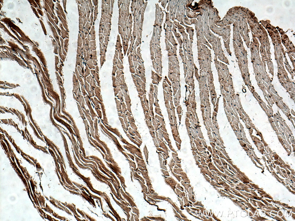 NF-κB p65 Antibody IHC mouse heart tissue 10745-1-AP