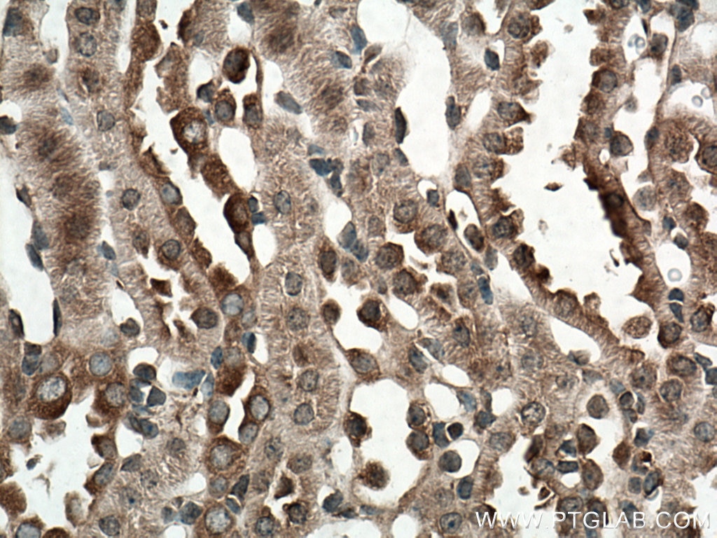 NF-κB p65 Antibody IHC mouse kidney tissue 10745-1-AP