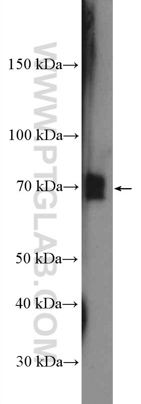 NF-κB p65 Antibody WB mouse liver tissue 10745-1-AP