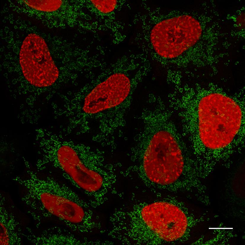 HeLa cells transfected with Tom70-eGFP and PCNA-mRFP and stained with GFP-Booster Alexa Fluor 488 (green) and RFP-Booster Alexa Fluor 568 (red). Images were recorded at the Core Facility Bioimaging, LMU Munich. Scale bar 10 µm.