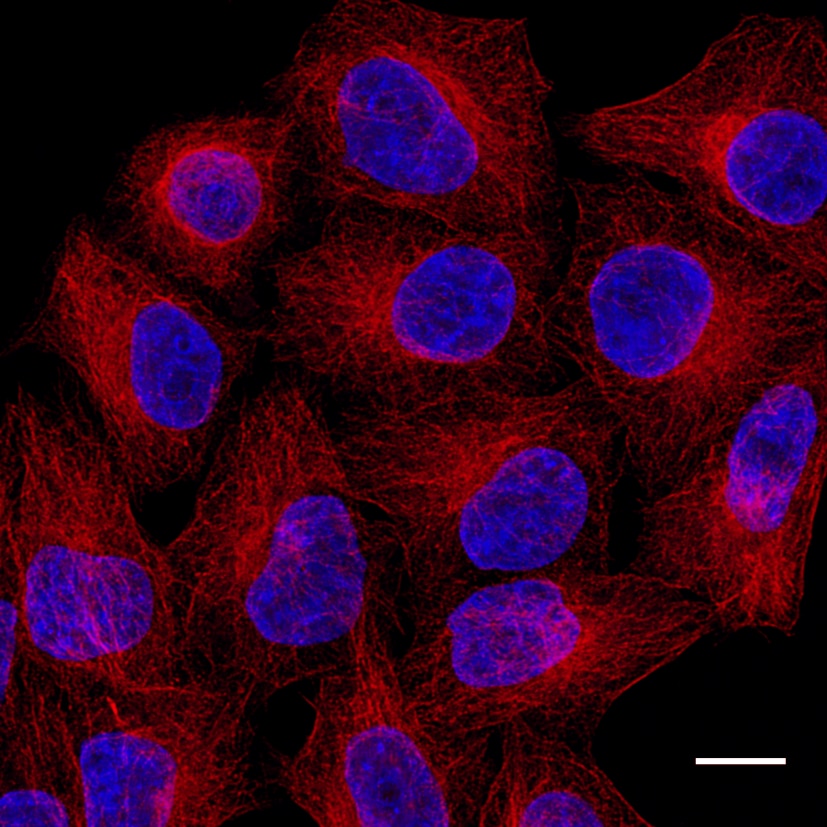 HeLa cells were immunostained with mouse IgG1 anti-αTubulin antibody + alpaca anti-mouse IgG1 VHH Alexa Fluor? 568 (red). Nuclei were stained with DAPI (blue). Scale bar, 10 μm. Images were recorded at the Core Facility Bioimaging at the Biomedical Center, LMU Munich.