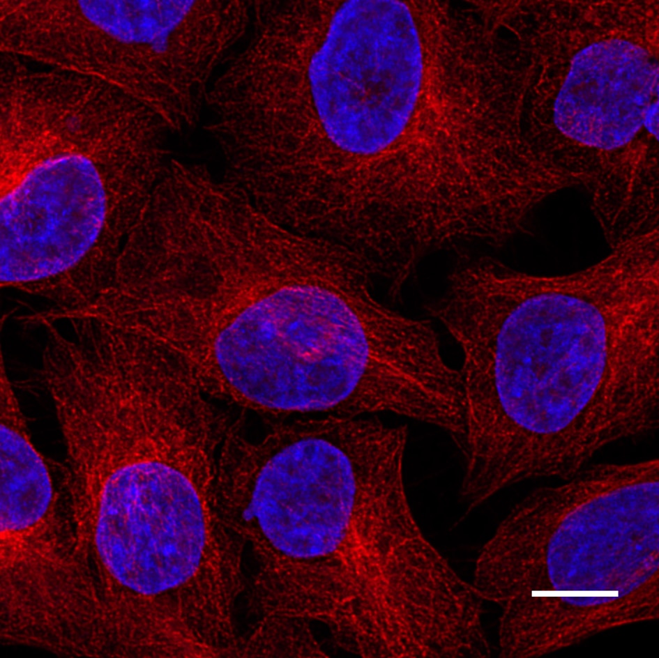 HeLa cells were immunostained with mouse IgG2b anti-βTubulin antibody + alpaca anti-mouse IgG2b VHH Alexa Fluor? 568 (red). Nuclei were stained with DAPI (blue). Scale bar, 10 μm. Images were recorded at the Core Facility Bioimaging at the Biomedical Center, LMU Munich