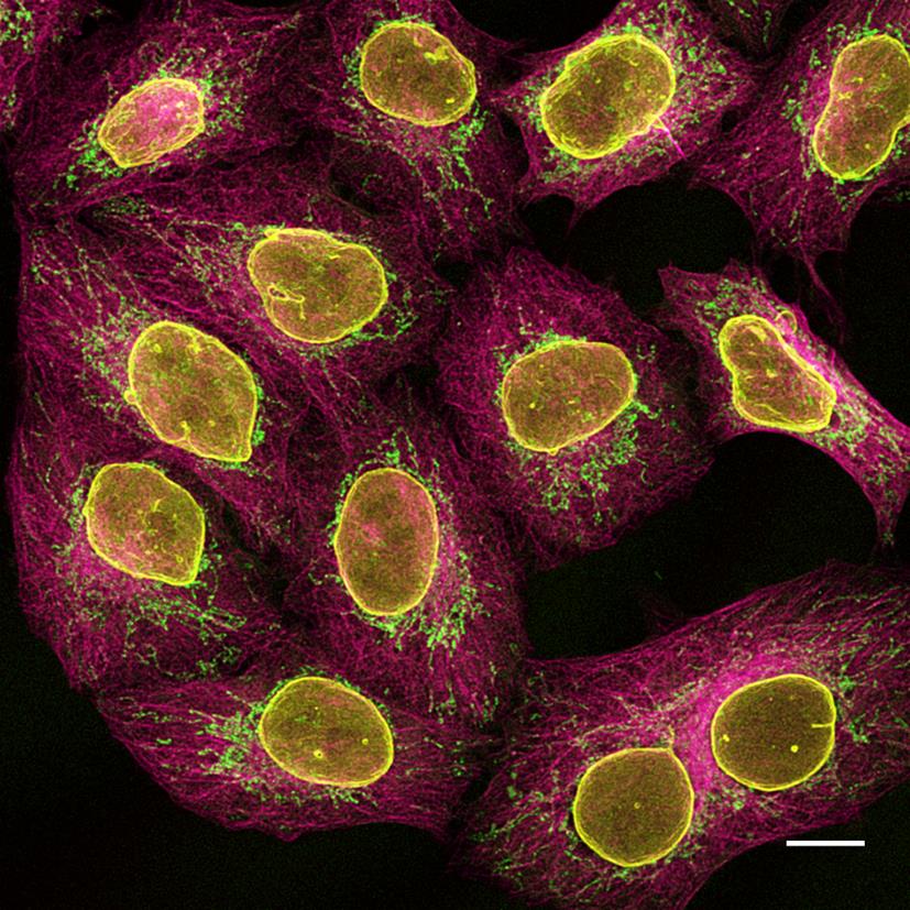 Multiplexed immunostaining of HeLa cells with two alpaca anti-mouse Nano-Secondaries and one anti-rabbit Nano-Secondary. Green: mouse IgG1 anti-COX4 + alpaca anti-mouse IgG1 VHH Alexa Fluor? 488. Magenta: mouse IgG2b anti-Tubulin + alpaca anti-mouse IgG2b VHH Alexa Fluor? 647. Yellow: rabbit anti-Lamin + alpaca anti-rabbit IgG VHH Alexa Fluor? 568. Scale bar, 10 μm. Images were recorded at the Core Facility Bioimaging at the Biomedical Center, LMU Munich.