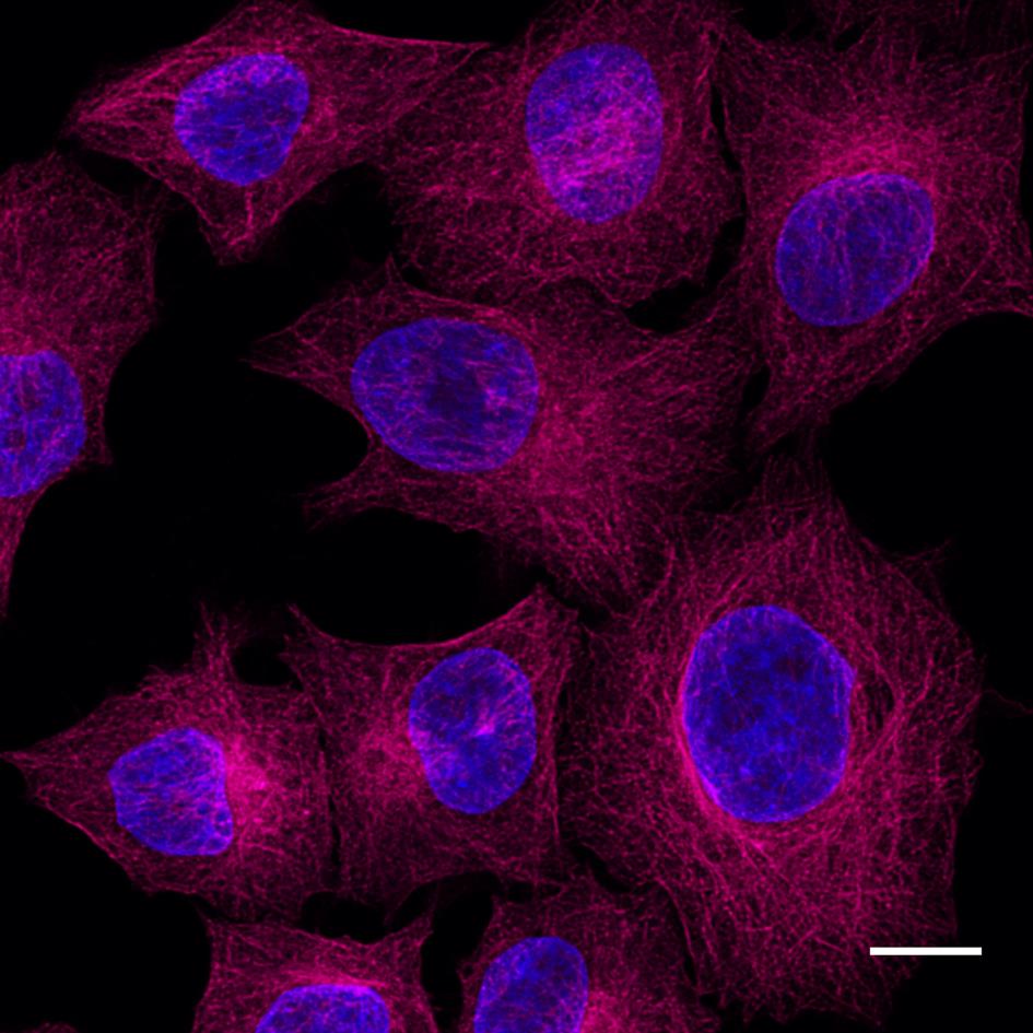 HeLa cells were immunostained with mouse IgG2b anti-?-Tubulin antibody + alpaca anti-mouse IgG2b VHH Alexa Fluor? 647 (magenta). Nuclei were stained with DAPI, blue. Scale bar, 10 μm. Images were recorded at the Core Facility Bioimaging at the Biomedical Center, LMU Munich.