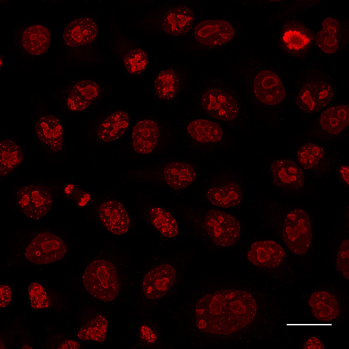 Alpaca anti-rabbit IgG VHH Alexa Fluor? 568 was applied together with rabbit anti-Ki67 antibodies for detection of Ki67 (red) in HeLa cells. Scale bar, 20 μm. Images were recorded at the Core Facility Bioimaging at the Biomedical Center, LMU Munich.