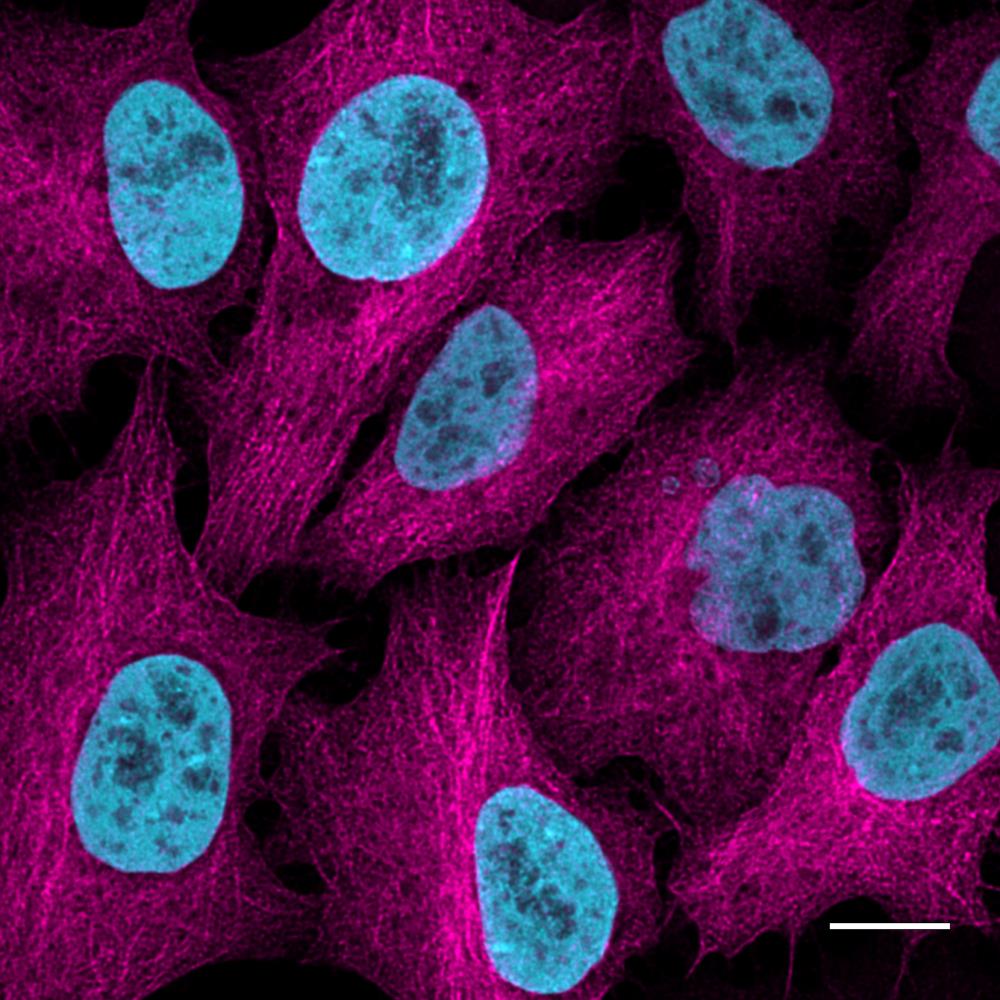 HeLa cells stably expressing Tubulin-GFP at near-endogenous level were immunostained with rabbit anti-GFP PABG1 antibody and alpaca anti-rabbit IgG VHH Alexa Fluor? 647 (magenta). Nuclei were detected with H2B-RFP and RFP-Booster Atto594 (cyan). Scale bar, 10 μm. Images were recorded at the Core Facility Bioimaging at the Biomedical Center, LMU Munich.