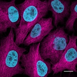 Staining image of Tubulin-GFP immunostained with rabbit anti-GFP PABG1 antibody and ChromoTek Nano-Secondary® alpaca anti-human IgG/anti-rabbit IgG, recombinant VHH, Alexa Fluor 647