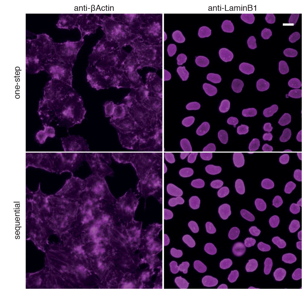 One-step immunostaining (top row) vs. sequential immunostaining (bottom row) of HeLa cells. Anti-β-Actin (left column) and anti-LaminB1 (right column) primary rabbit antibodies + secondary alpaca anti-rabbit IgG VHH Alexa Fluor? 647. Scale bar, 20 μm.