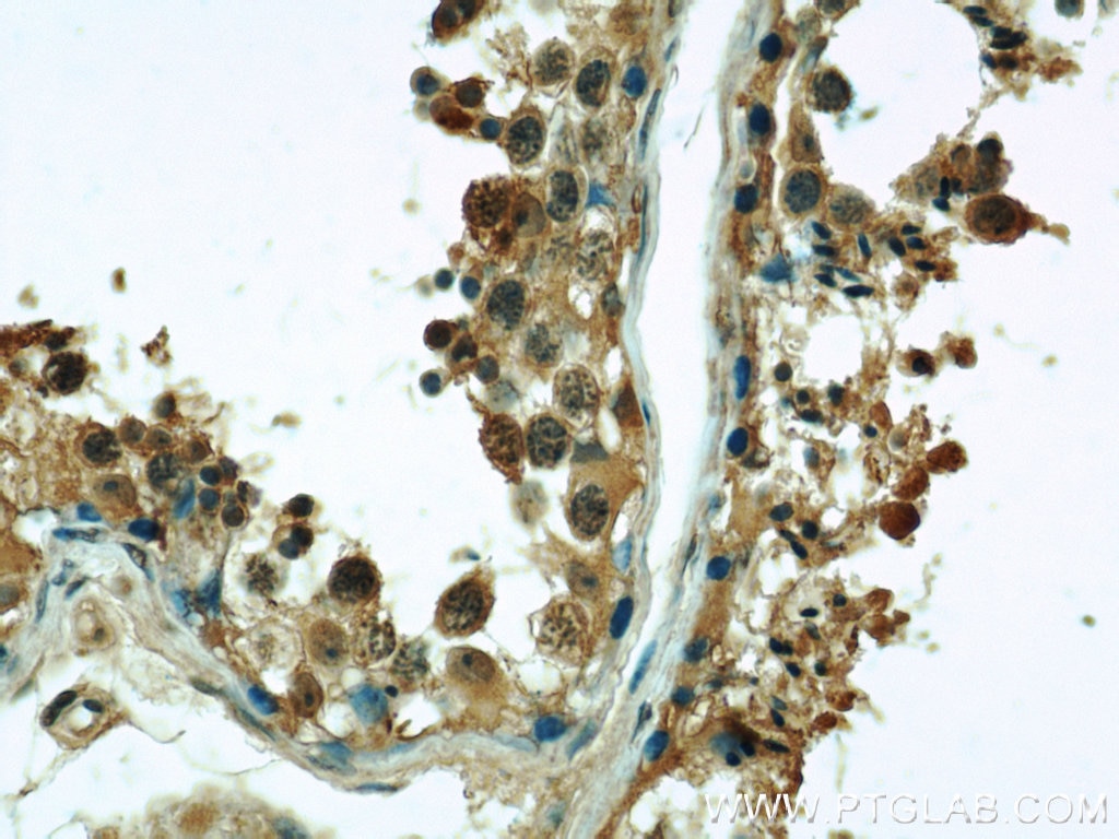 Alpha Tubulin Antibody IHC human testis tissue 66031-1-Ig