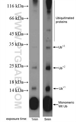 MDA-MB-453s cells were subjected to SDS PAGE followed by western blot with 10201-2-AP ( ubiquitin Antibody) at dilution of 1:600
