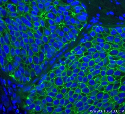 organelle markers adheren junctions markers