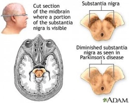 The Neurochemistry Of Parkinson S Disease Proteintech Group