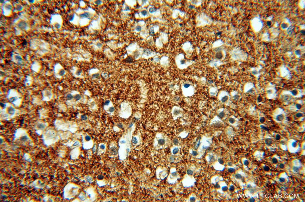 IHC of paraffin-embedded human brain using SNCA antibody