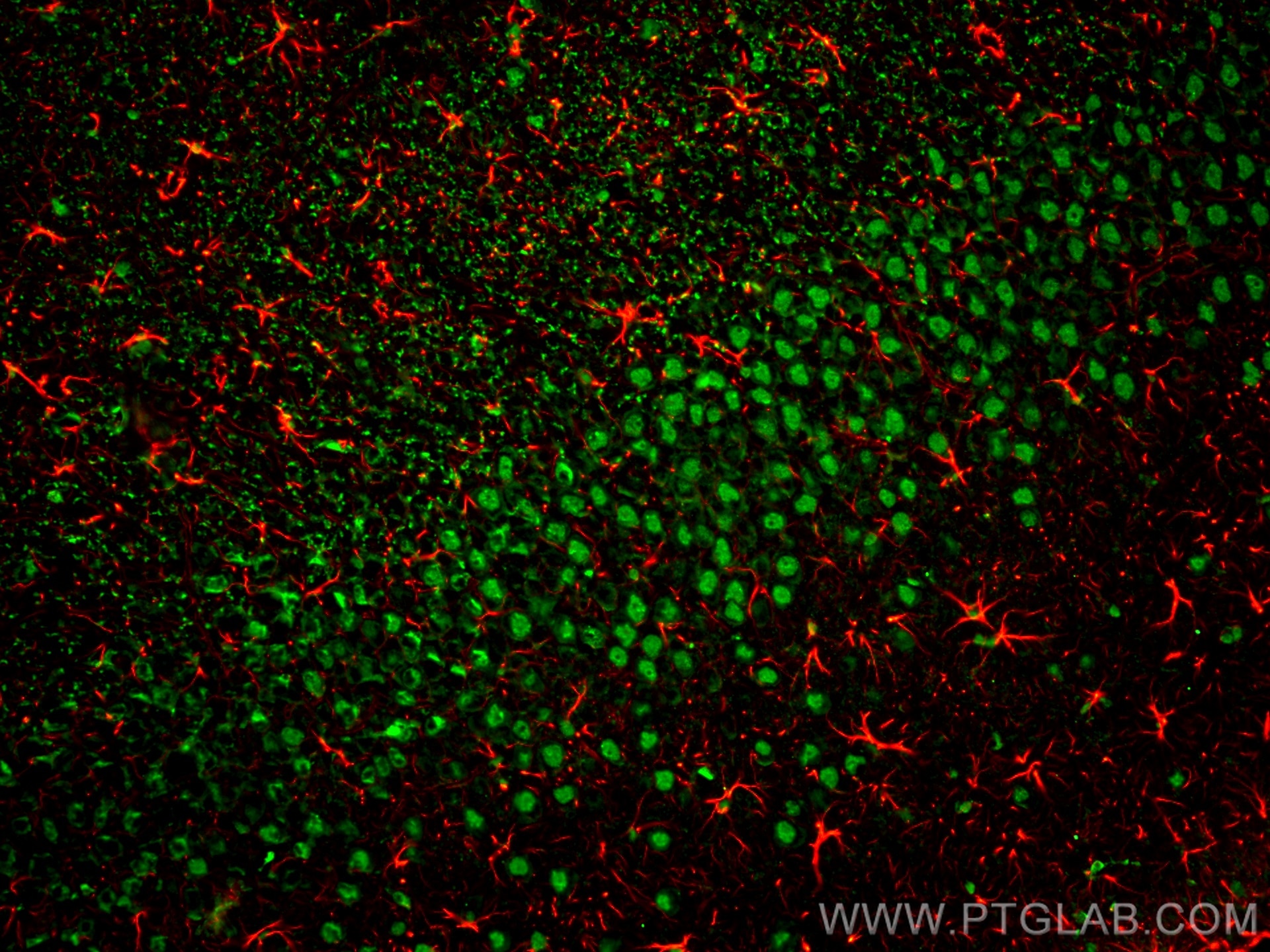 Immunofluorescence (IF) analysis of rat brain FFPE section stained with rabbit anti-GFAP polyclonal antibody (16825-1-AP, red) and mouse anti-NeuN monoclonal antibody (66836-1-Ig, green). Multi-rAb CoraLite® Plus 594 Goat Anti-Rabbit Recombinant Secondary Antibody (H+L) (RGAM004, 1:500) and Multi-rAb CoraLite® Plus 488-Goat Anti-Mouse Recombinant Secondary Antibody (H+L) (RGAM002, 1:500) were used for detection.  