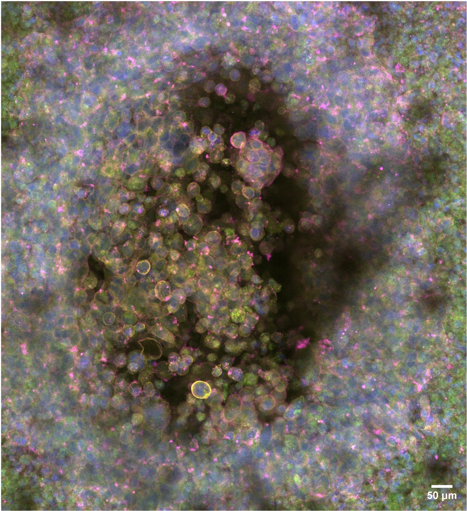 A Fluorescence Microscopy Toolkit for Whole-Volume, Subcellular ...