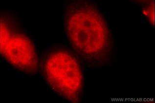 Immunofluorescent analysis of HeLa cells using 15821-1-AP( PK-M1-specific Antibody) at dilution of 1:50 and Rhodamine-Goat anti-Rabbit IgG