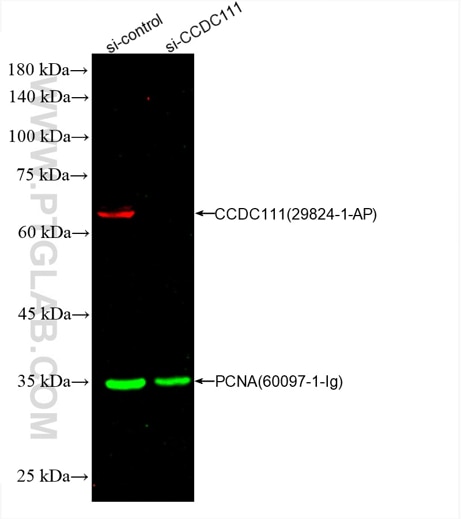 WB of HepG2 cell lysates: siRNA transfected HepG2 cell lysates were detected with anti-CCDC111 antibody (29824-1-AP) labeled with FlexAble CoraLite® Plus 647 Kit (KFA003, red) and anti-PCNA antibody (60097-1-Ig) labeled with FlexAble CoraLite® Plus 555 Kit (KFA022, green).