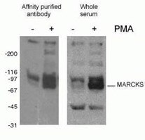 Post Translational Modifications An Overview Proteintech Group