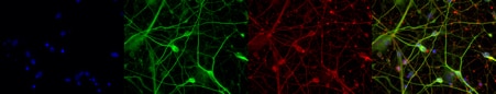 Immunofluorescent staining of MAP2 and TUBB3 antibodies