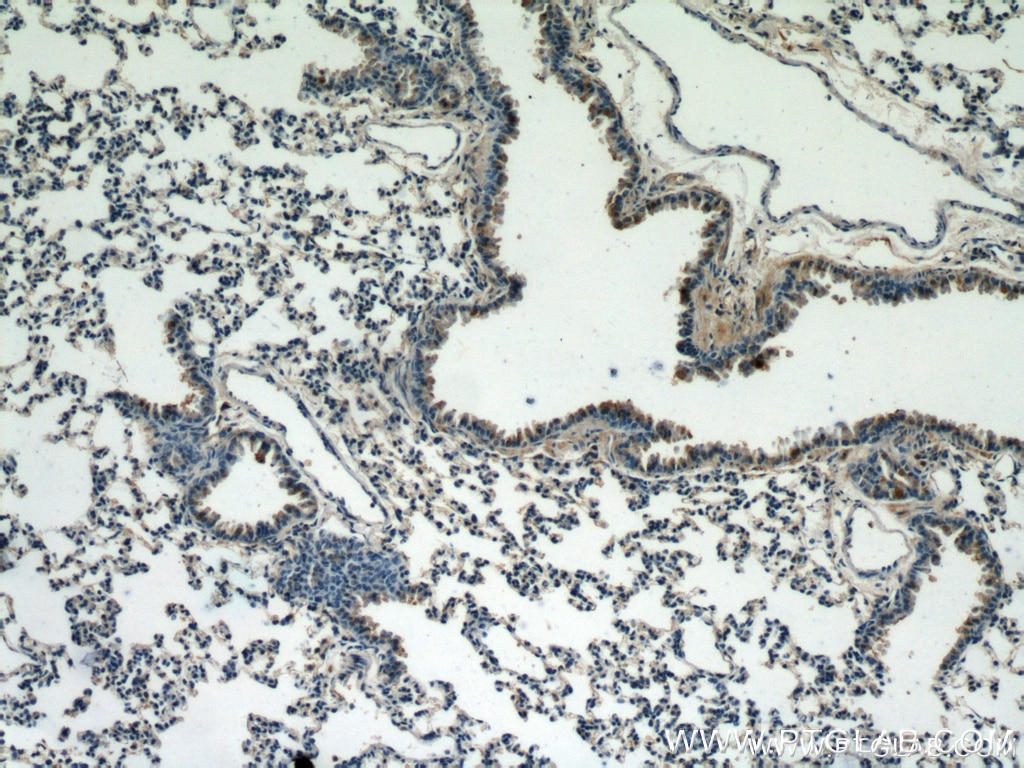 Immunohistochemistry of paraffin-embedded mouse lung tissue slide using Caspase 9/p35/p10 antibody