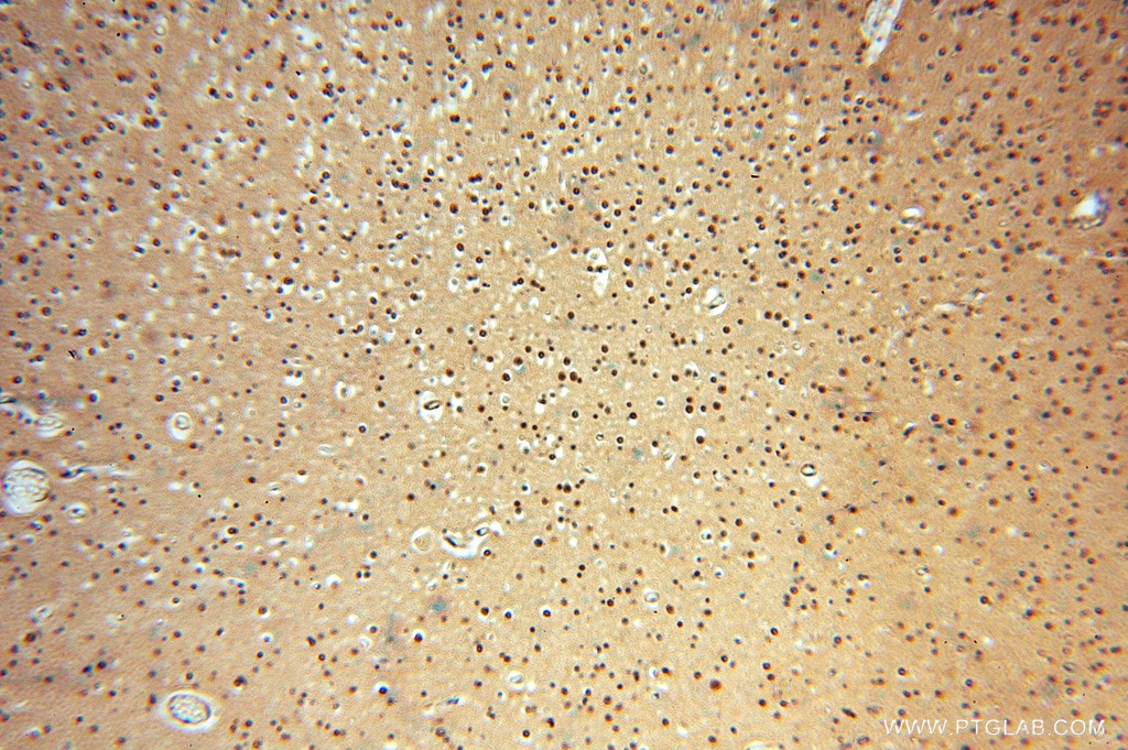 Immunohistochemical staining of paraffin-embedded human brain using SOD1 antibody