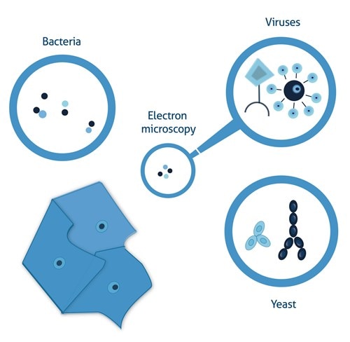 Cell contamination | Proteintech Group Cell contamination | Proteintech Group