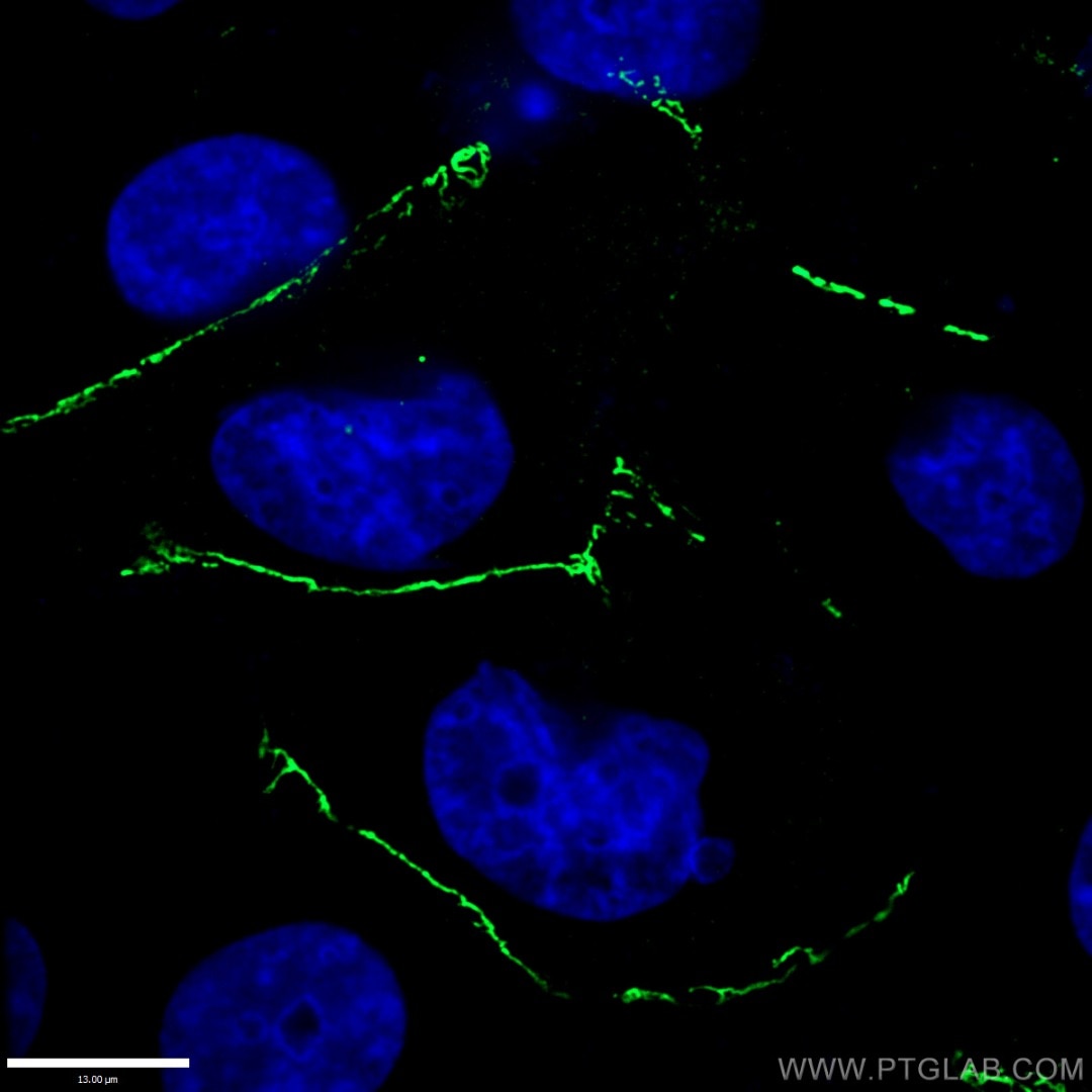 Immunofluorescent analysis of fixed HUVEC cells using ZO-1 antibody