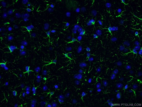 GFAP抗体、Alexa Fluor 488標識AffiniPureヤギ抗ウサギIgG（H＋L）を使用したマウス脳組織（4% PFA固定）の免疫蛍光染色