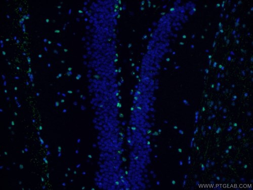 SOX2抗体、Alexa Fluor 488標識AffiniPureヤギ抗ウサギIgG（H＋L）を使用したマウス脳組織（4% PFA固定）の免疫蛍光染色