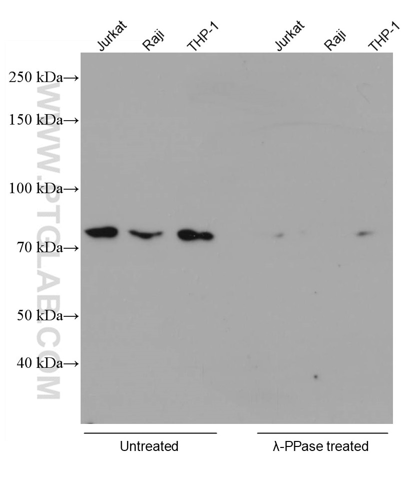 Various lysates were subjected to SDS PAGE followed by WB with 66854-1-Ig (RIPK1 phospho-S161 antibody) at a dilution of 1:5000 incubated at room temperature for 1.5 hours. The cell lysates were untreated (left) or treated with Lambda Protein Phosphatase (lamda-PPase, 500U, right) at 37oC for 1 hour before the blocking step.