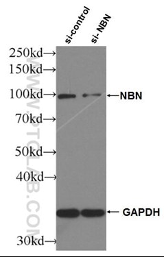 NBS1抗体のウェスタンブロット検証