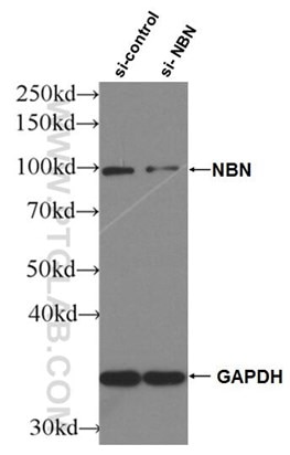 WB result of NBS1 antibody (55025-1-AP; 1:2000; incubated at room temperature for 1.5 hours) with sh-Control and sh-NBS1 transfected HeLa cells