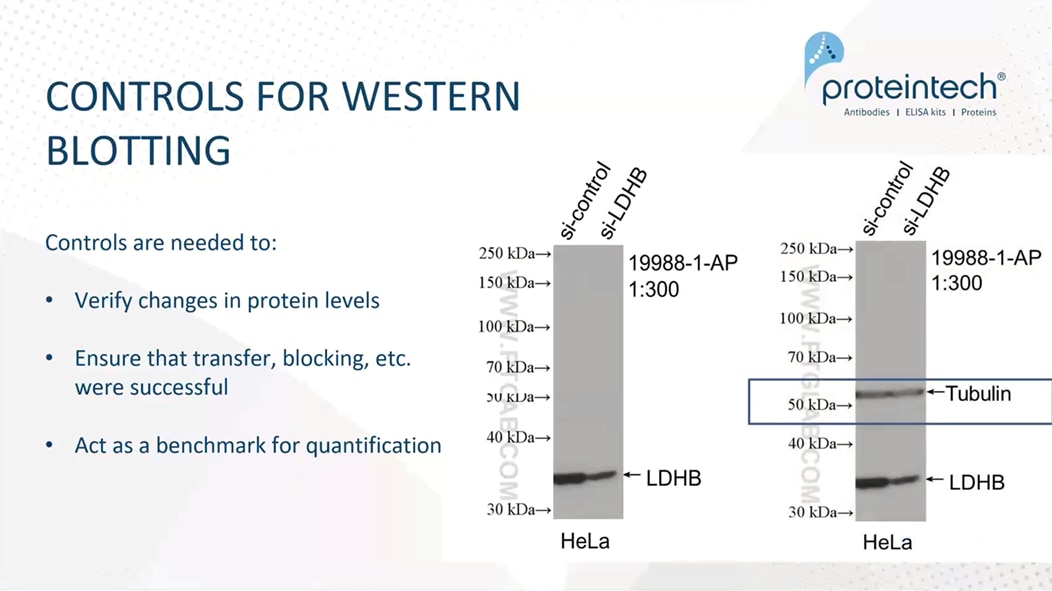 Reasons why loading controls are needed for your experiments