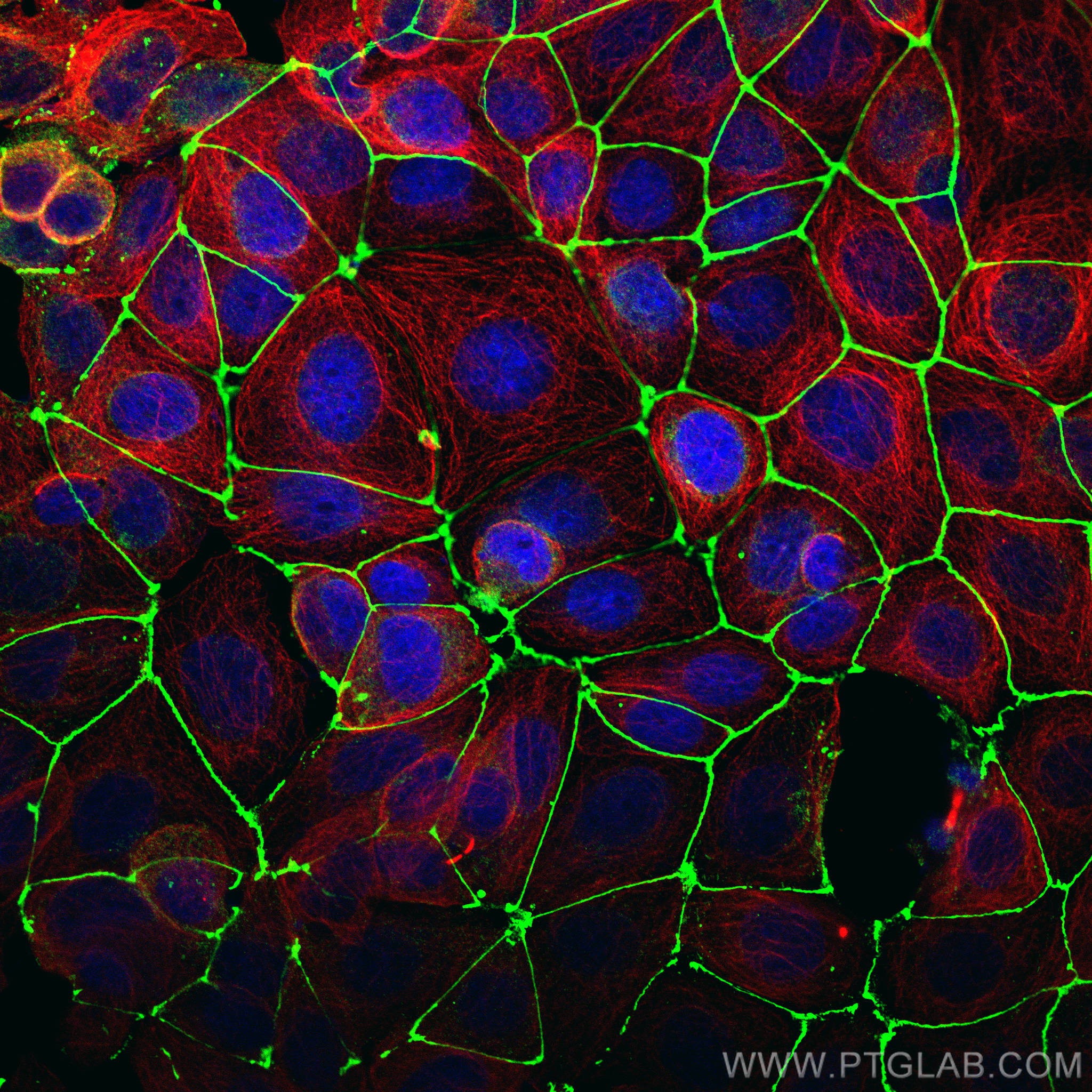 Immunofluorescence (IF) analysis of MCF-7 cells stained with rabbit anti-ZO1 polyclonal antibody (21773-1-AP, green) and mouse anti-Alpha Tubulin monoclonal antibody (66031-1-Ig, red). Multi-rAb CoraLite® Plus 488-Goat Anti-Rabbit Recombinant Secondary Antibody (H+L) (RGAR002, 1:500) and Multi-rAb CoraLite® Plus 594-Goat Anti-Mouse Recombinant Secondary Antibody (H+L) (RGAM004, 1:500) were used for detection.
