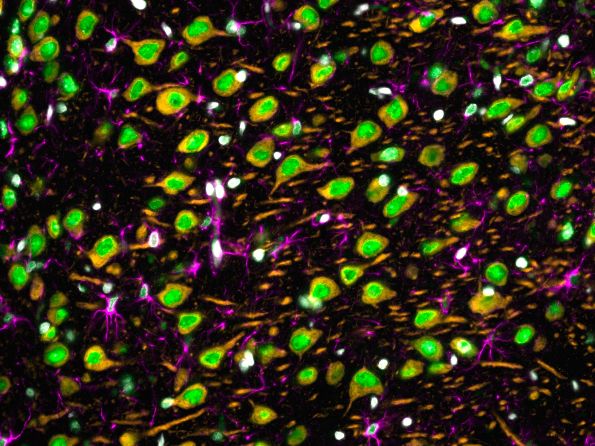 Immunofluorescence of rat brain tissue: FFPE rat brain tissue sections were stained with anti-MAP2 antibody (17490-1-AP) labeled with FlexAble CoraLite® Plus 555 Kit (KFA002, orange), anti-GFAP antibody (16825-1-AP) labeled with FlexAble CoraLite® Plus 647 Kit (KFA003, magenta) and CoraLite®488-conjugated TDP-43 antibody (CL488-10782, green).