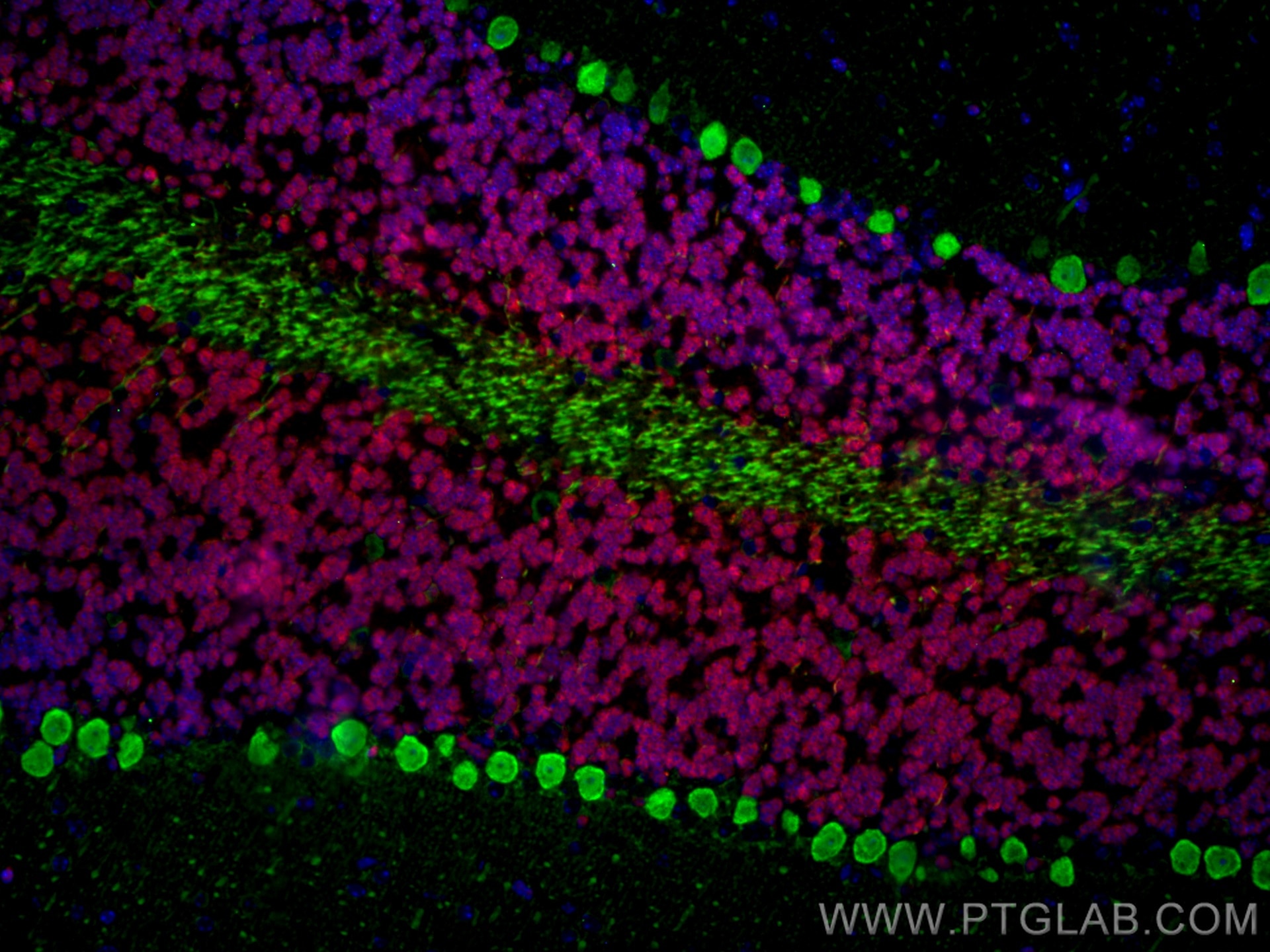 Immunofluorescence (IF) analysis of mouse cerebellum FFPE tissue stained with rabbit anti-NeuN polyclonal antibody (26975-1-AP, red) and mouse anti-Calbindin-D28k monoclonal antibody (66394-1-Ig, green). Multi-rAb CoraLite® Plus 594-Goat Anti-Rabbit Secondary Antibody (H+L) (RGAM004, 1:500) and Multi-rAb CoraLite® Plus 647-Goat Anti-Mouse Recombinant Secondary Antibody (H+L) (RGAM002, 1:500) were used for detection.  
