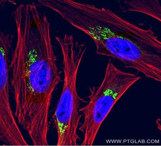 organelle markers golgi markers