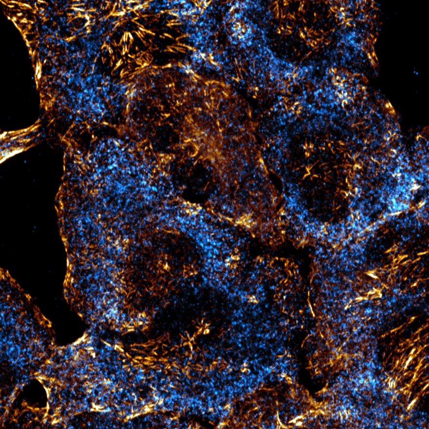 Microscopic image showing orange and blue cellular structures, possibly stained for specific features, against a dark background. The intricate patterns highlight the texture and complexity of the cells.
