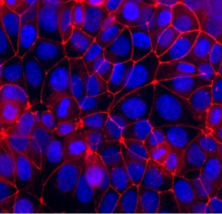 organelle markers tight junctions markers