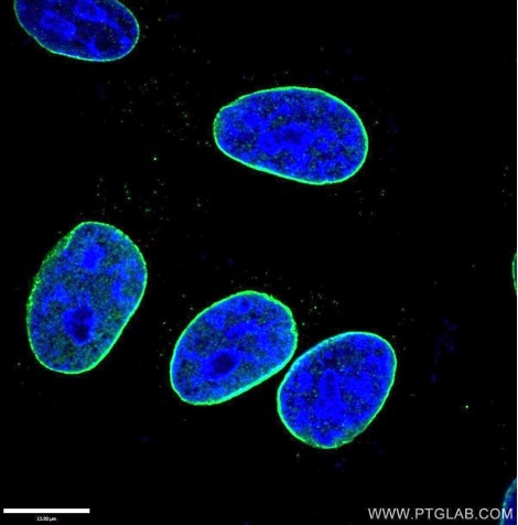 organelle markers nuclear membrane markers