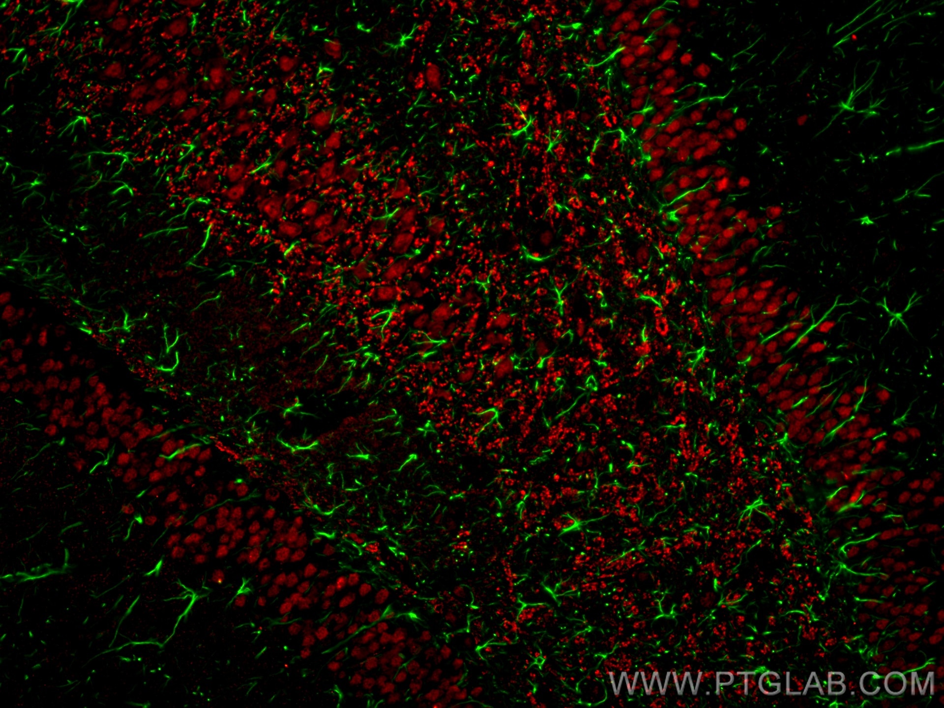 Immunofluorescence (IF) analysis of rat brain FFPE tissue stained with rabbit anti-GFAP polyclonal antibody (16825-1-AP, green) and mouse anti-NeuN monoclonal antibody (66836-1-Ig, red). Multi-rAb CoraLite® Plus 488-Goat Anti-Rabbit Secondary Antibody (H+L) (RGAM002, 1:500) and Multi-rAb CoraLite® Plus 594-Goat Anti-Mouse Recombinant Secondary Antibody (H+L) were (RGAM004, 1:500) used for detection.