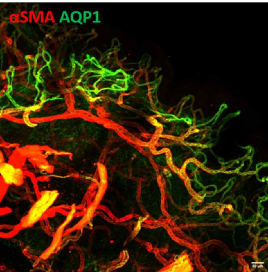 IF Imaging of 3D vascular structure in foreskin after Skin-iDISCO+ tissue clearing