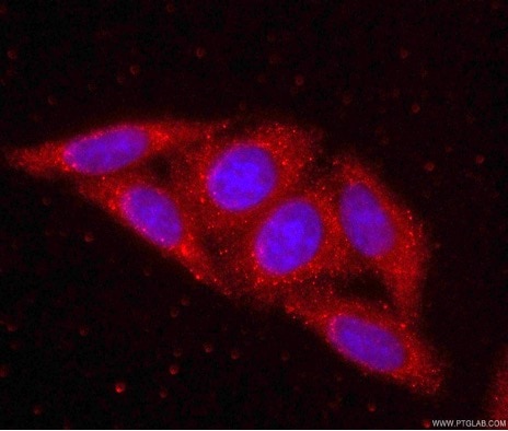 organelle markers ribosome markers